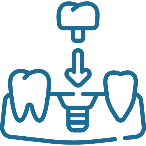 What Happens During a Root Canal?